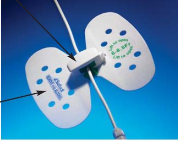 Catheter / Line Securement Device Small, 6 to 8.5FR